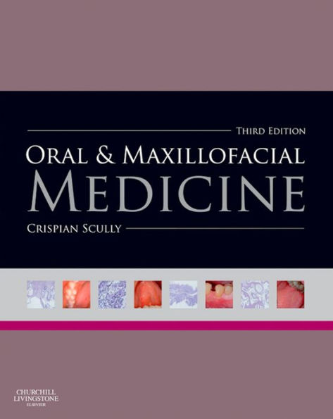 Oral and Maxillofacial Medicine: The Basis of Diagnosis and Treatment