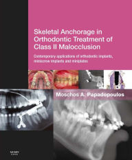 Title: Skeletal Anchorage in Orthodontic Treatment of Class II Malocclusion E-Book: Skeletal Anchorage in Orthodontic Treatment of Class II Malocclusion E-Book, Author: Moschos A. Papadopoulos DDS