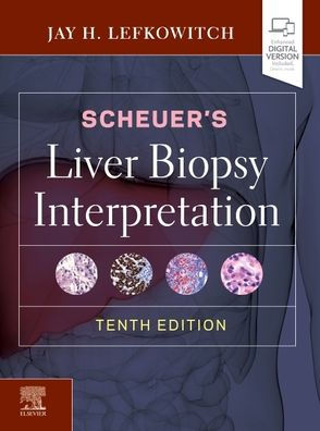 Scheuer's Liver Biopsy Interpretation / Edition 10