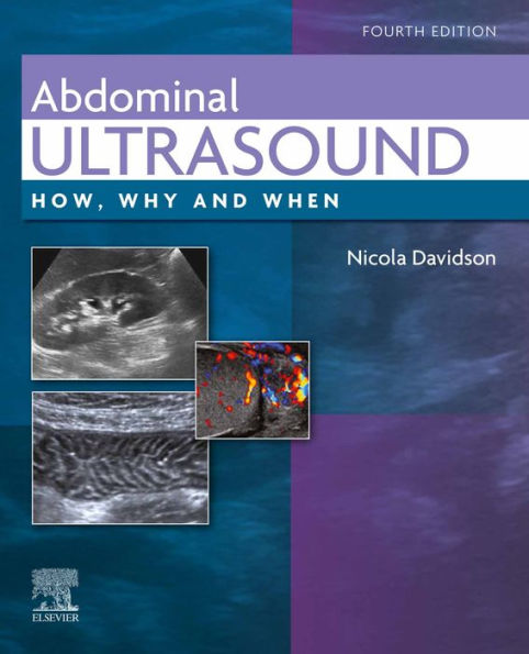 Abdominal Ultrasound E-Book: Abdominal Ultrasound E-Book