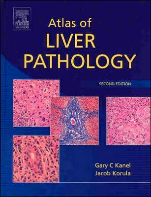 Atlas of Liver Pathology