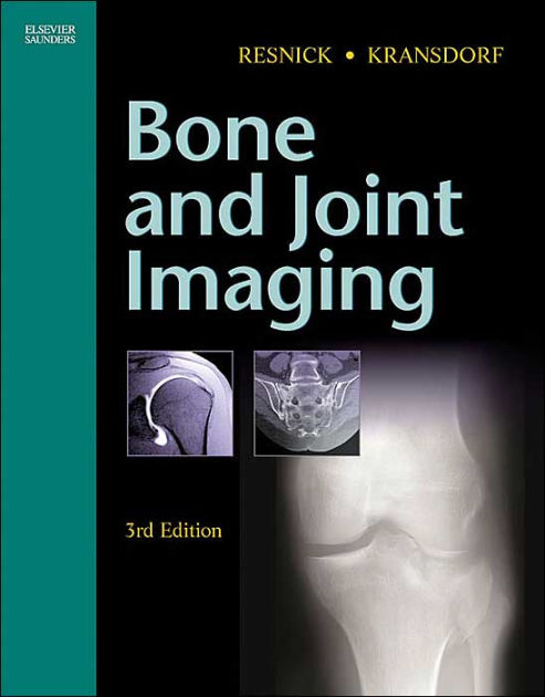 Barnes　and　L.　Hardcover　Bone　Kransdorf　9780721602707　Edition　MD　J.　Mark　Joint　MD,　Resnick　Donald　by　Imaging　Noble®