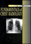 Fundamentals of Chest Radiology / Edition 1