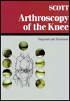 Arthroscopy of the Knee: Diagnosis and Treatment / Edition 1