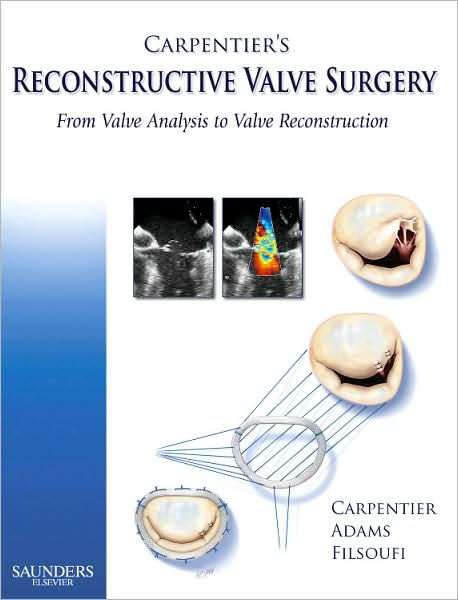 Carpentier's Reconstructive Valve Surgery: 1st edition