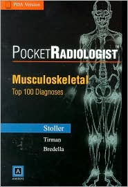 PocketRadiologist - Musculoskeletal: Top 100 Diagnoses, CD-ROM PDA Software - Palm OS Version