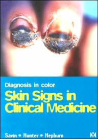 Diagnosis In Color: Skin Signs in Clinical Medicine / Edition 1
