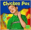 Chicken Pox
