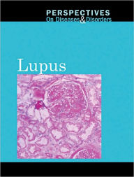 Title: Lupus, Author: Hayley Mitchell Haugen