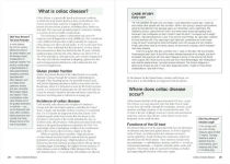 Alternative view 2 of Complete Gluten-Free Diet and Nutrition Guide: With a 30-Day Meal Plan and Over 100 Recipes