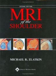 MRI of the Shoulder / Edition 2