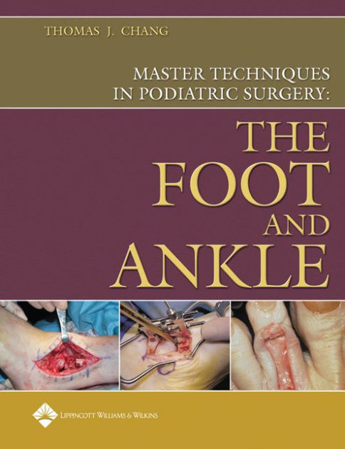 Master Techniques In Podiatric Surgery: The Foot And Ankle By Thomas J ...