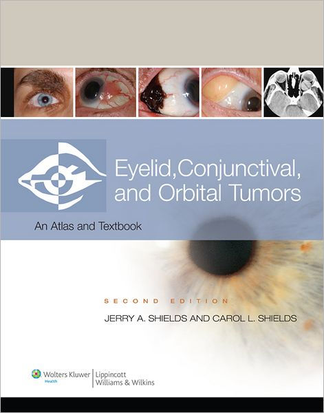 Eyelid Tumors, Second Edition