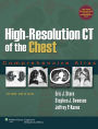 High-Resolution CT of the Chest: Comprehensive Atlas / Edition 3