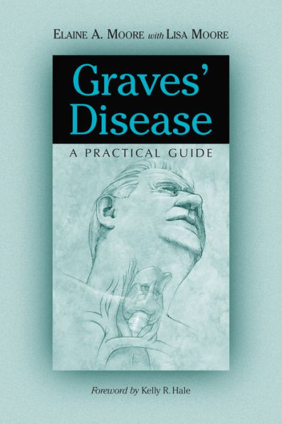 Graves' Disease: A Practical Guide