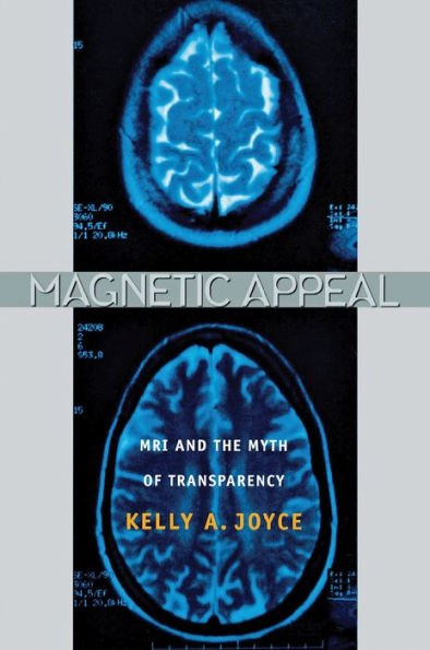Magnetic Appeal: MRI and the Myth of Transparency / Edition 1
