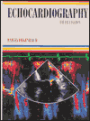 Feigenbaum's Echocardiography / Edition 5