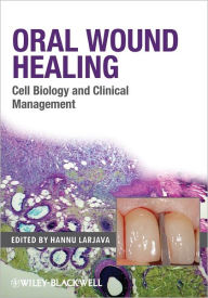 Title: Oral Wound Healing: Cell Biology and Clinical Management / Edition 1, Author: Hannu Larjava