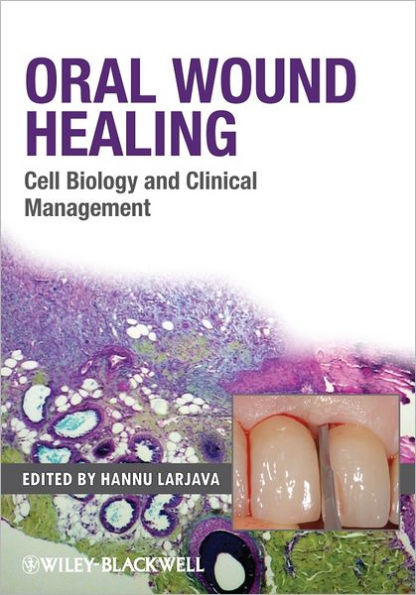 Oral Wound Healing: Cell Biology and Clinical Management / Edition 1