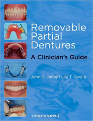 Title: Removable Partial Dentures: A Clinician's Guide / Edition 1, Author: John D. Jones