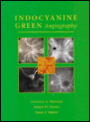 Indocyanine Green Angiography