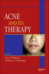 Title: Acne and Its Therapy / Edition 1, Author: Guy F. Webster