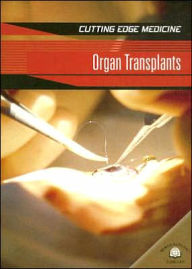 Organ Transplants