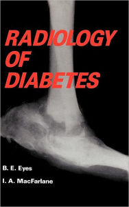 Title: Radiology of Diabetes / Edition 1, Author: B. Eyes