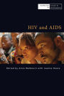 HIV and AIDS