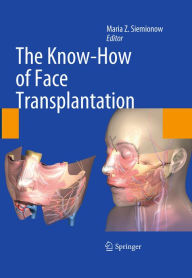 Title: The Know-How of Face Transplantation, Author: Maria Z. Siemionow