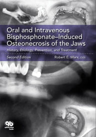 Title: Oral and Intravenous Bisphosphonate-Induced Osteonecrosis of the Jaws: History, Etiology, Prevention, and Treatment, Second Edition, Author: Robert E. Marx