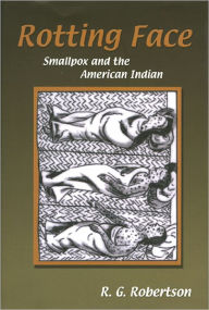 Rotting Face: Smallpox and the American Indian