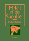 MRI of the Shoulder / Edition 1