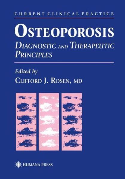 Osteoporosis: Diagnostic and Therapeutic Principles / Edition 1