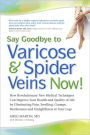 Say Goodbye to Varicose and Spider Veins Now!