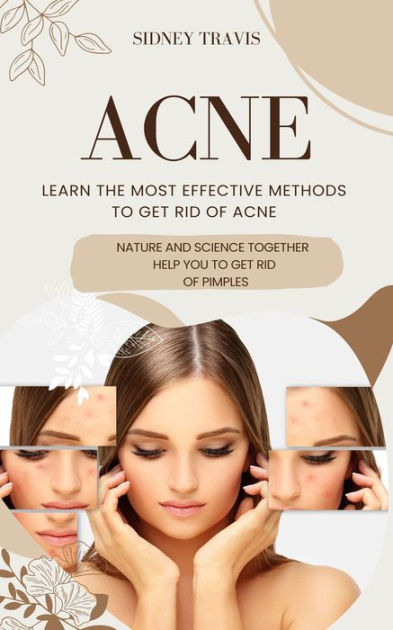 Acne Learn The Most Effective Methods To Get Rid Of Acne Nature And Science Together Help You 