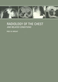Title: Radiology of the Chest and Related Conditions, Author: F W Wright