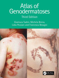 Title: Atlas of Genodermatoses, Author: Gianluca Tadini