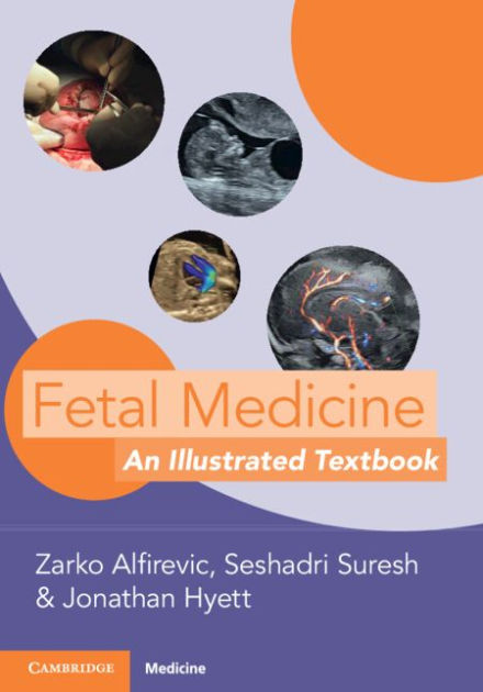 Fetal Medicine An Illustrated Textbook By Zarko Alfirevic Paperback Barnes And Noble® 