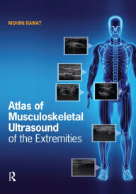 Title: Atlas of Musculoskeletal Ultrasound of the Extremities, Author: Mohini Rawat