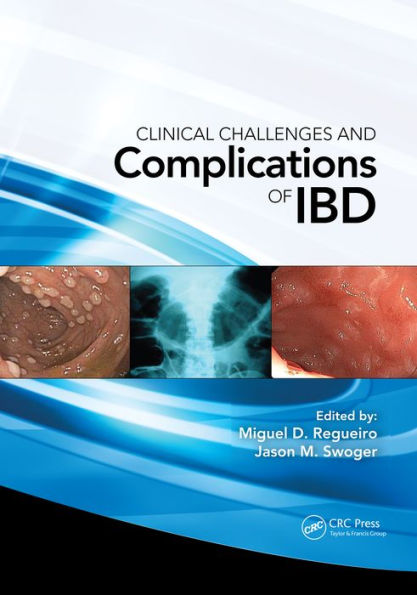 Clinical Challenges and Complications of IBD