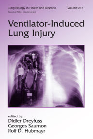 Title: Ventilator-Induced Lung Injury, Author: Didier Dreyfuss
