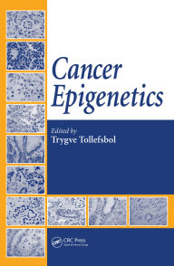 Title: Cancer Epigenetics, Author: Trygve Tollefsbol
