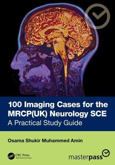 100 Imaging Cases for the MRCP Specialty Certificate Examination in Neurology: A Practical Study Guide