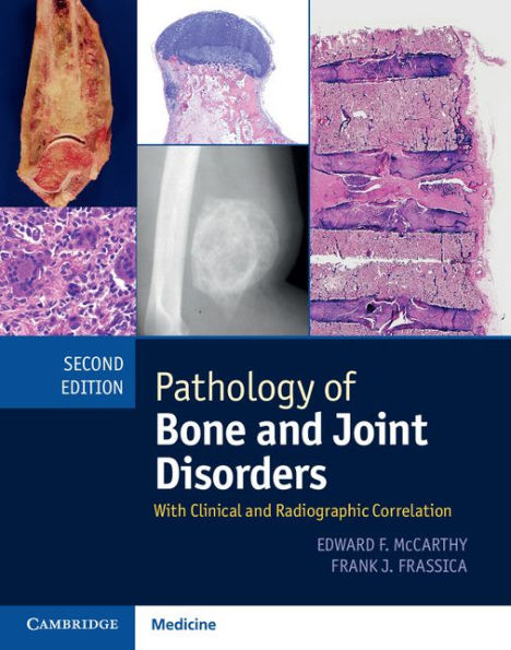 Pathology of Bone and Joint Disorders Print and Online Bundle: With Clinical and Radiographic Correlation / Edition 2