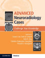 Advanced Neuroradiology Cases: Challenge Your Knowledge