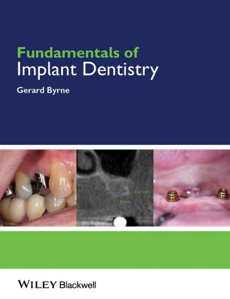 Fundamentals of Implant Dentistry / Edition 1