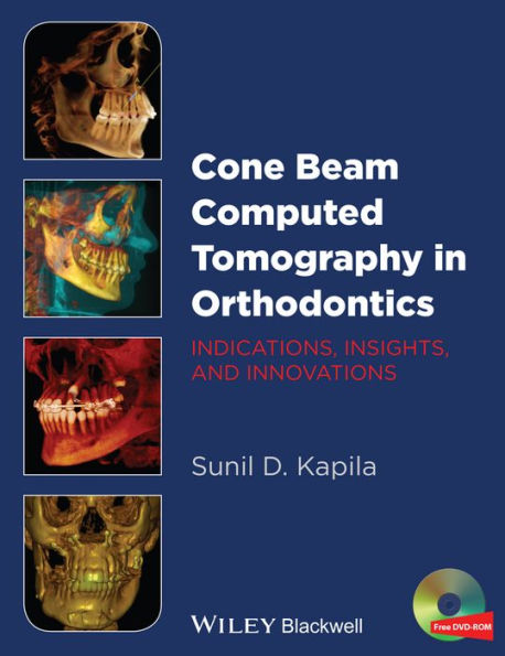 Cone Beam Computed Tomography in Orthodontics: Indications, Insights, and Innovations