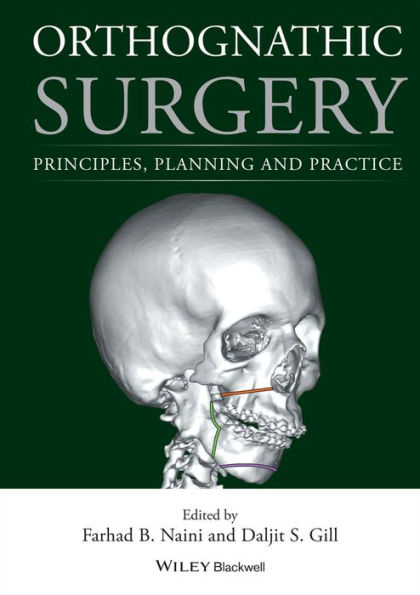 Orthognathic Surgery: Principles, Planning and Practice / Edition 1