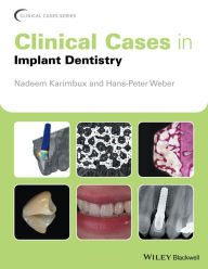 Title: Clinical Cases in Implant Dentistry / Edition 1, Author: Nadeem Karimbux